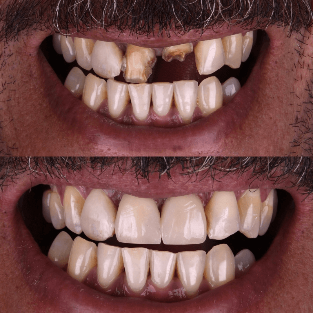 Resultado — Restauração Estética